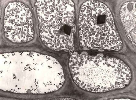 Phytoplasma Phytoplasma Casts a Magic Spell that Turns the Fair Poinsettia into