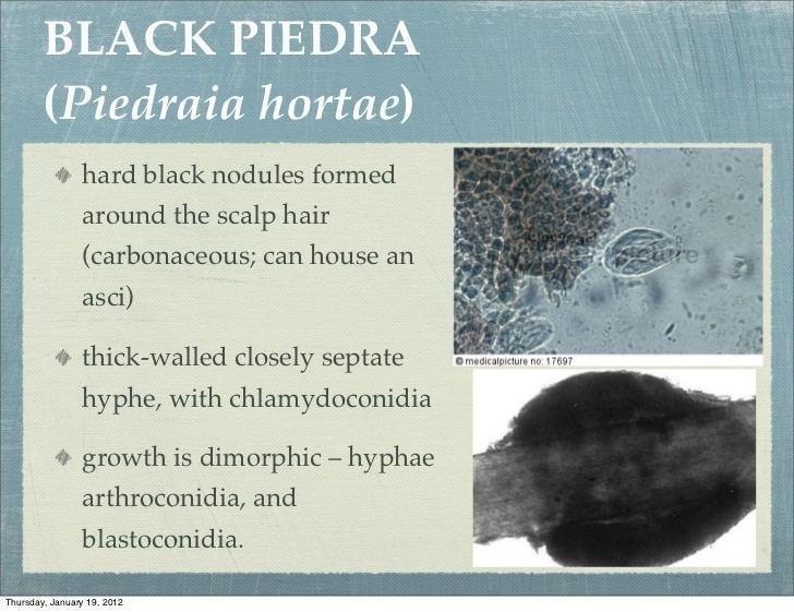 A slide presentation with images of Piedraia hortae on the right and descriptions on the left side