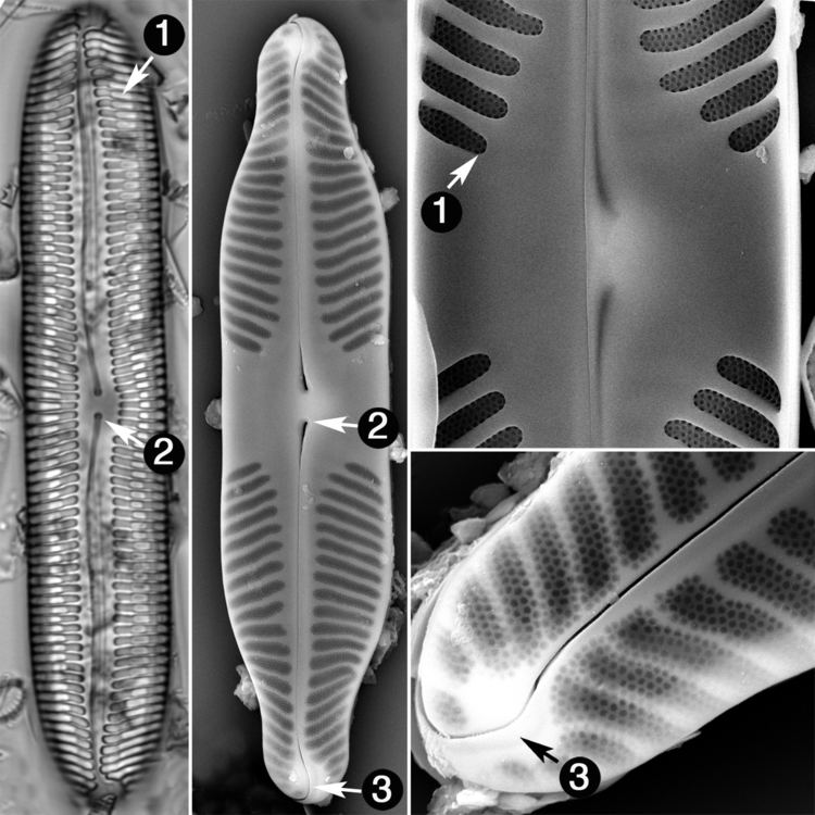 Pinnularia Pinnularia Diatoms of the United States