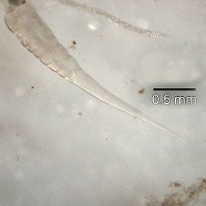 Pinworm (parasite)