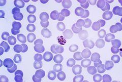 Plasmodium malariae httpsuploadwikimediaorgwikipediacommonsthu