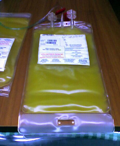 Platelet transfusion