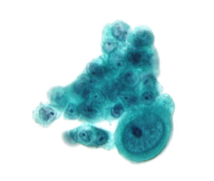 Pleomorphism (cytology)