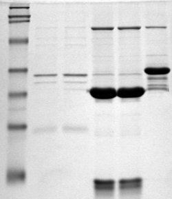 Polyacrylamide gel electrophoresis