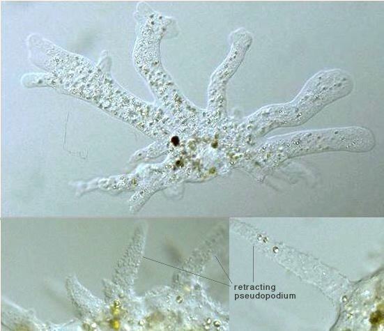 Polychaos dubium Protist Images Polychaos