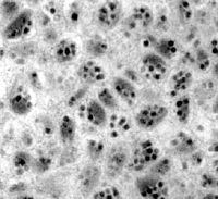 Polydnavirus httpsuploadwikimediaorgwikipediacommonsthu