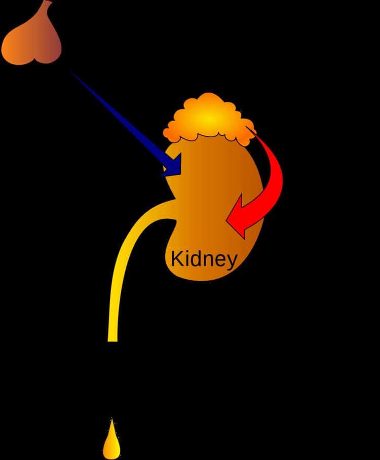 polyuria icd 10 code