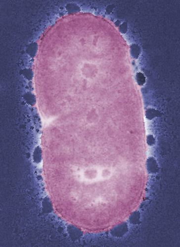 Porphyromonas gingivalis Porphyromonas gingivalis wwwmicrobiologybytescom Flickr