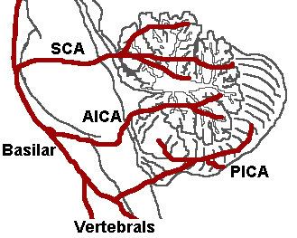 Posterior inferior cerebellar artery