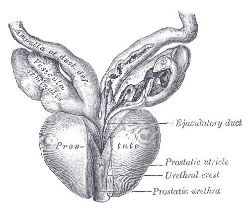 Posterior urethral valve