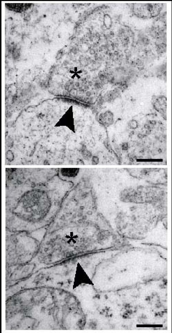 Postsynaptic density