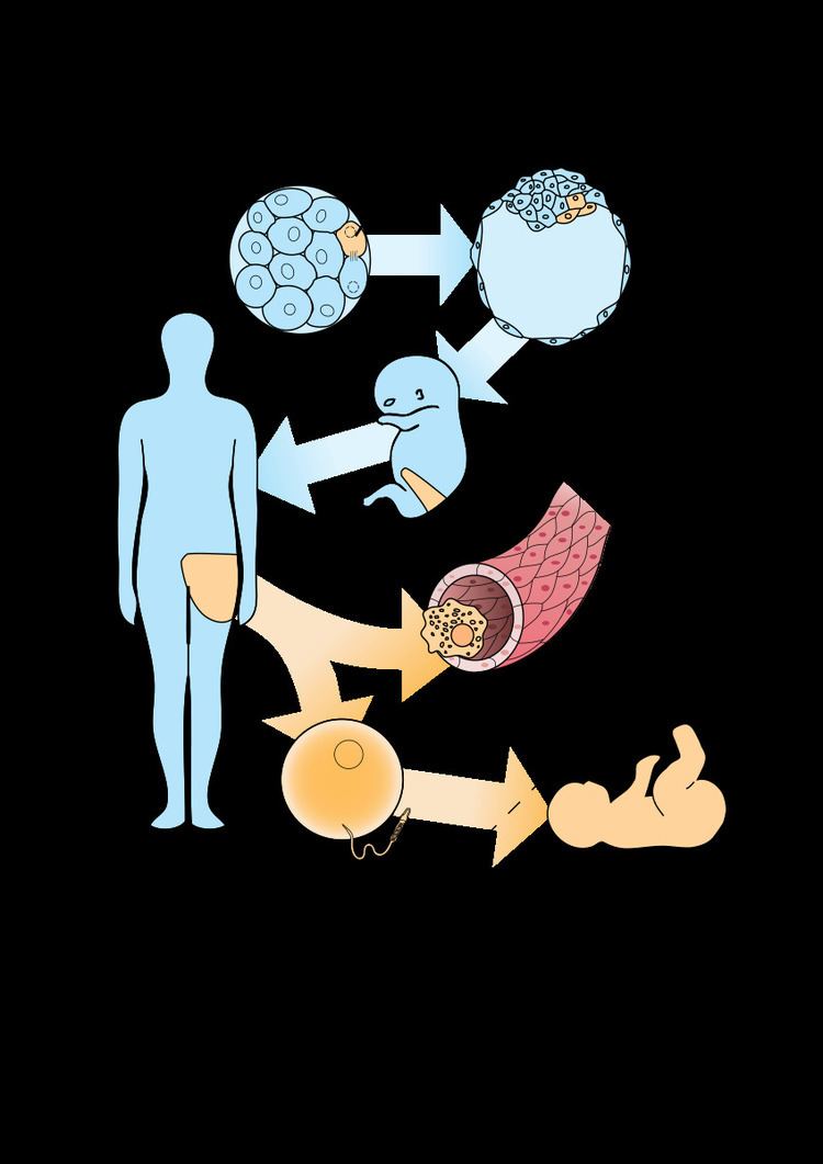 Postzygotic mutation