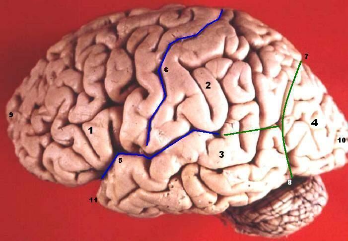 Preoccipital notch