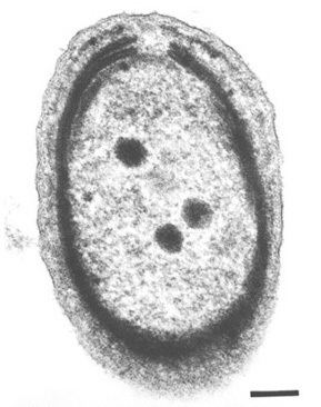 Prochlorococcus Prochlorococcus MicrobeWiki