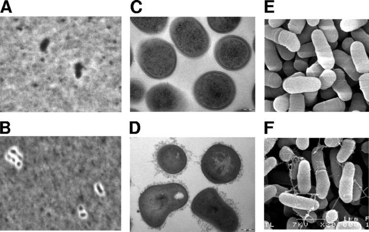 Propionibacterium freudenreichii aemasmorgcontent7692740F1largejpg