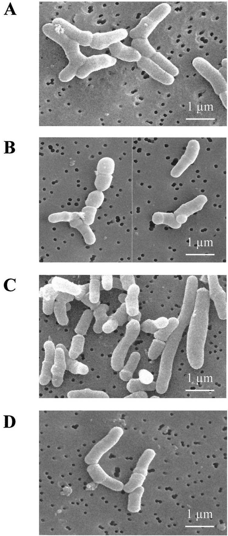 Propionibacterium freudenreichii Changes in Protein Synthesis and Morphology during Acid Adaptation