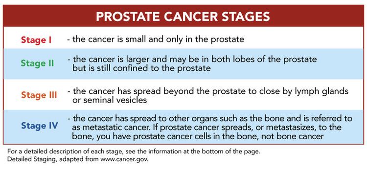 Prostate cancer staging Prostate cancer staging