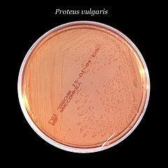 Proteus (bacterium) httpsuploadwikimediaorgwikipediacommonsthu