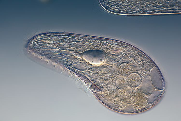 protozoa-everything-you-need-to-know-with-photos-videos