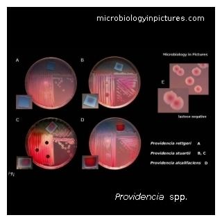 Providencia (bacterium) Microbiology pictures photo gallery of medically important