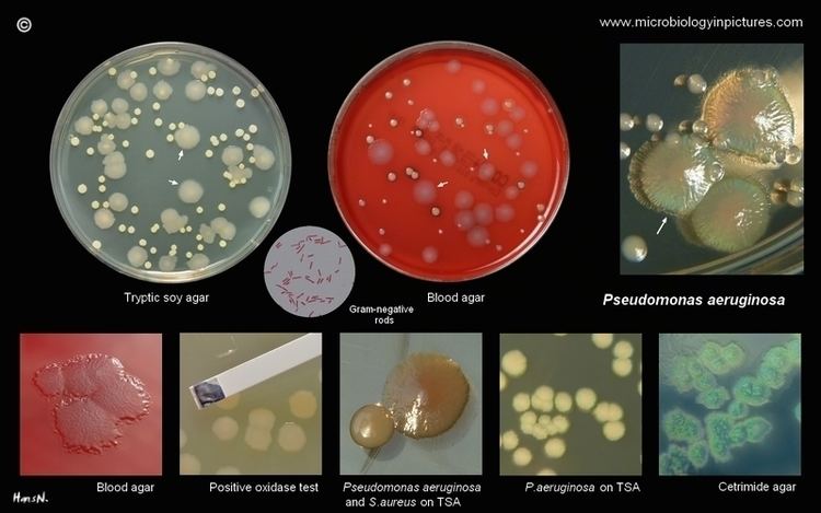 Pseudomonas Aeruginosa Alchetron The Free Social Encyclopedia 