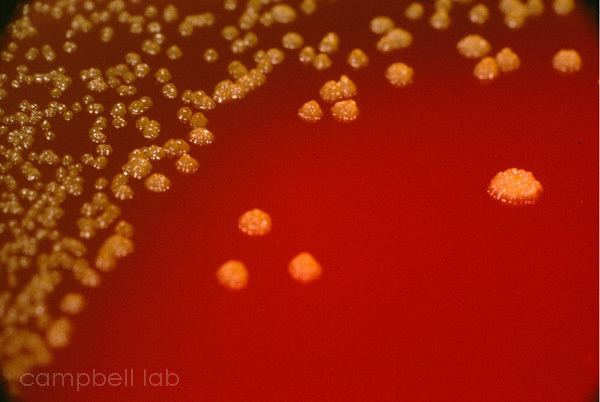 Pseudomonas oryzihabitans Bacteria Photo Gallery The Charles T Campbell Eye Microbiology