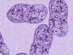 Purple bacteria Purple Bacteria