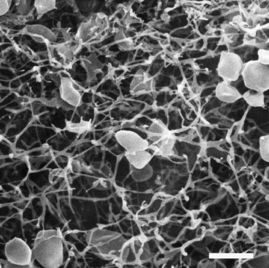 Pyrodictium Scanning electron micrograph of a network of Pyrodictium Figure