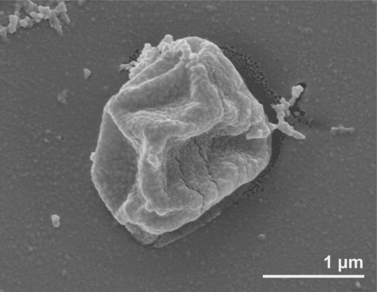 Pyrolobus fumarii Pyrolobus fumarii type strain 1AT GEBA Genome Papers Pinterest