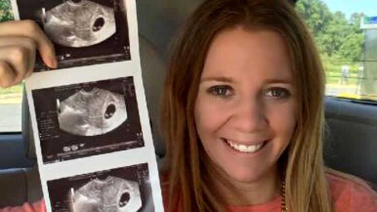 Rachelle Friedman Paralyzed bride39 expecting first child through surrogate