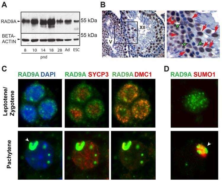 RAD9A The DNA damage checkpoint protein RAD9A is essential for male