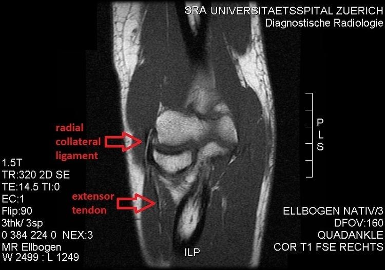 Radial collateral ligament of elbow joint