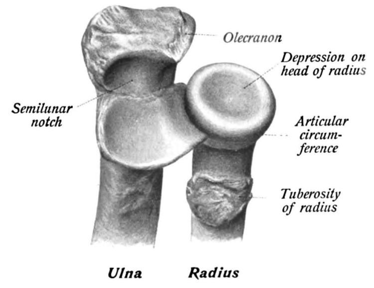 Radial tuberosity