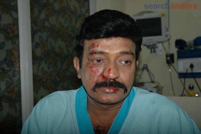 Rajasekhar (actor) Actor Rajasekhar Injured Photo Gallery Actor Rajasekhar