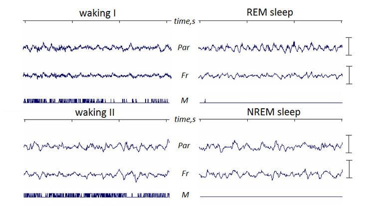 Rapid eye movement sleep