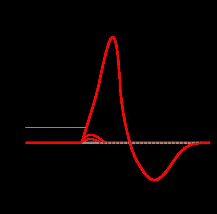 Refractory Period Psychology Definition