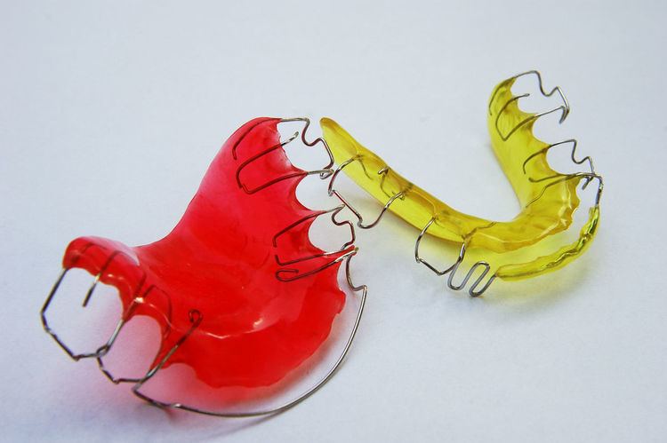 Retainer (orthodontics)