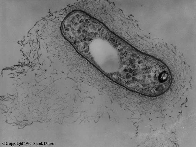 Rhizobia DLCME The Microbe Zoo Dirtland Root Cellar Rhizobium