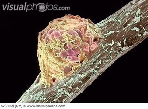 Rhizobium 10 Best images about Green plant symbionts on Pinterest Biology