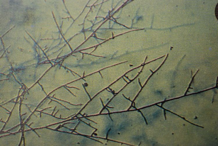 Rhizoctonia solani Solani Mycelium 2