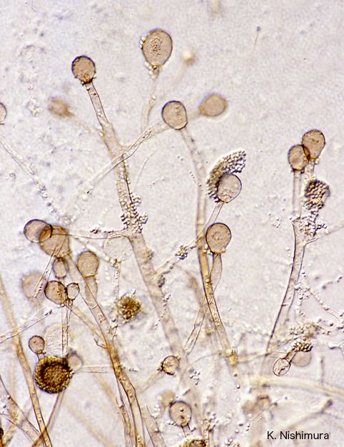 Rhizomucor Rhizomucor pusillus microscopy2