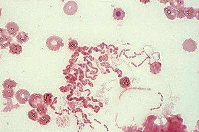Rhodobacter httpsmicrobewikikenyoneduimagesthumb22dR