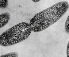 Rhodobacter sphaeroides genomejgidoegovrhosprhospgif