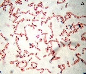 Rhodococcus Rhodococcus spp Dog