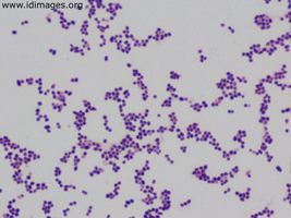 Rhodococcus equi Rhodococcus Images Partners Infectious Disease Images eMicrobes