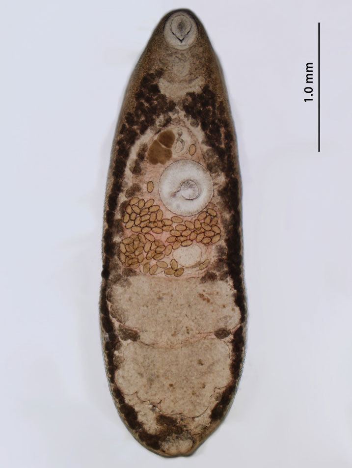 Ribeiroia ondatrae Aquatic Parasite Observatory