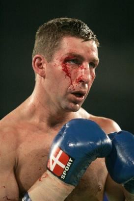 Éric Lucas Photos Canadian boxer Eric Lucas with cuts on his right eyebrow