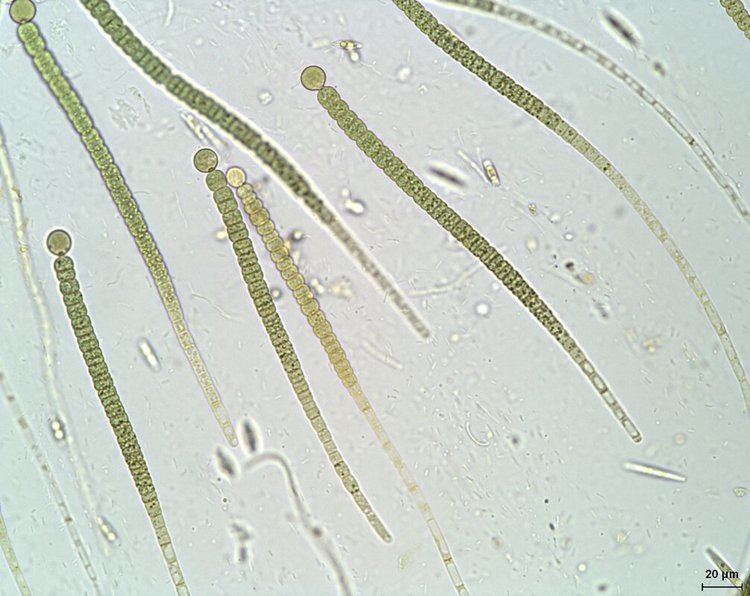 Rivularia dbmusebladecoloradoeduDiatomTwosbsacsiteimag