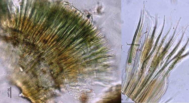Rivularia Rivularia microscopesandmonsters