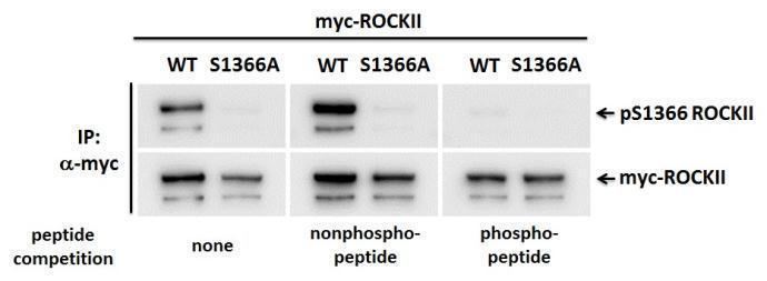 ROCK2 antiROCK2 phospho Ser1366 antibody GeneTex